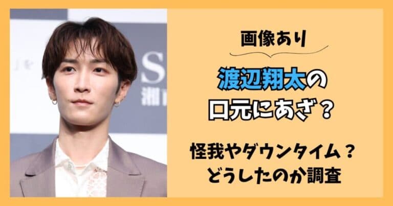 【画像】渡辺翔太の口元にあざ？怪我やダウンタイム？どうしたのか調査